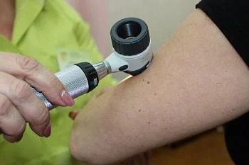 В Центральной городской клинической больнице пройдет акция по профилактике меланомы В Центральной городской клинической больнице пройдет акция по профилактике меланомы